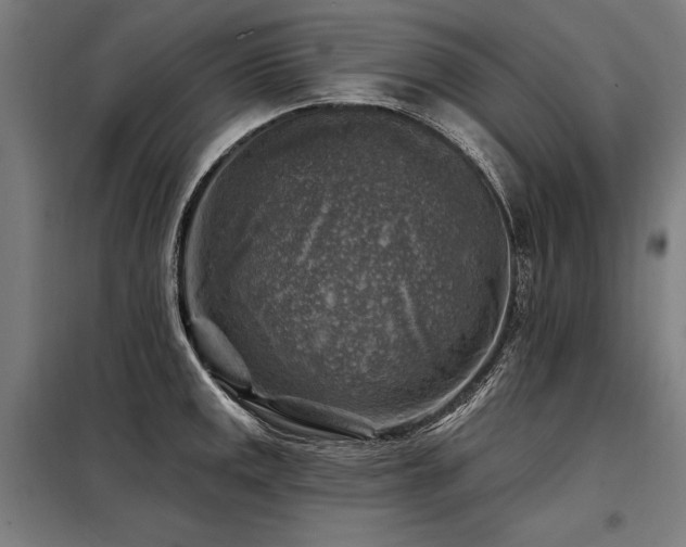X0000098171141200804241150