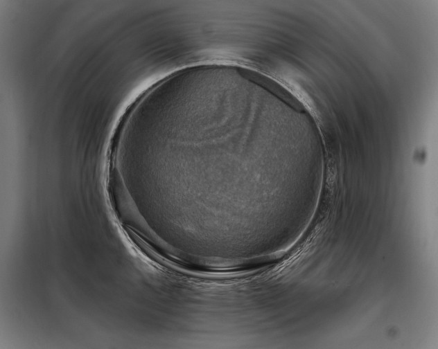 X0000098171144200804241150