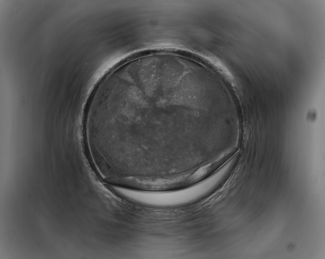 X0000098171279200804241147