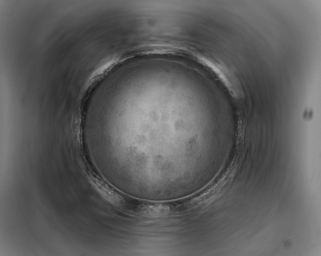 X0000098171403200804241145