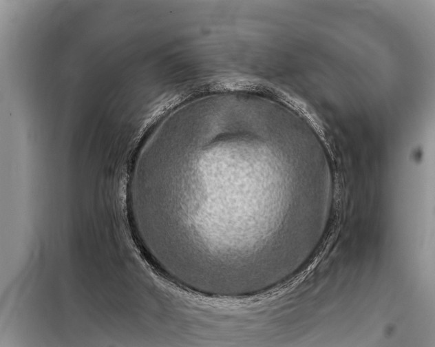 X0000098170010200805011024