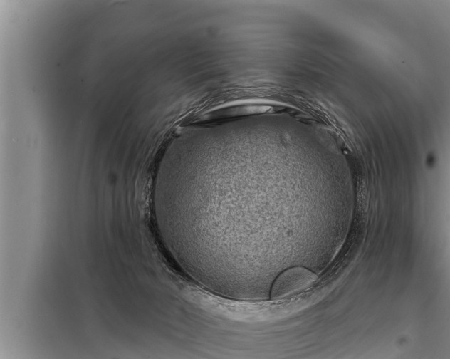 X0000098170030200805011023