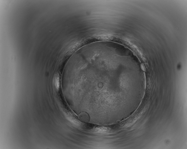 X0000098170069200805011023