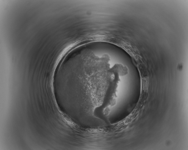 X0000098170147200805011021