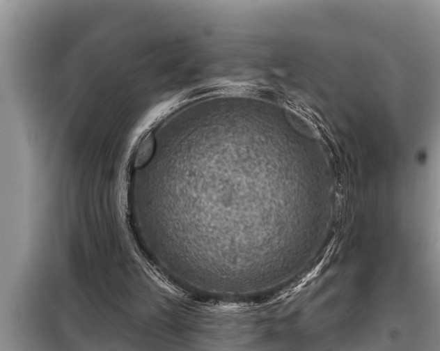 X0000098170149200805011021