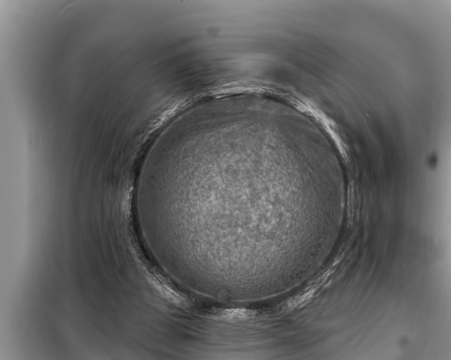 X0000098170153200805011021