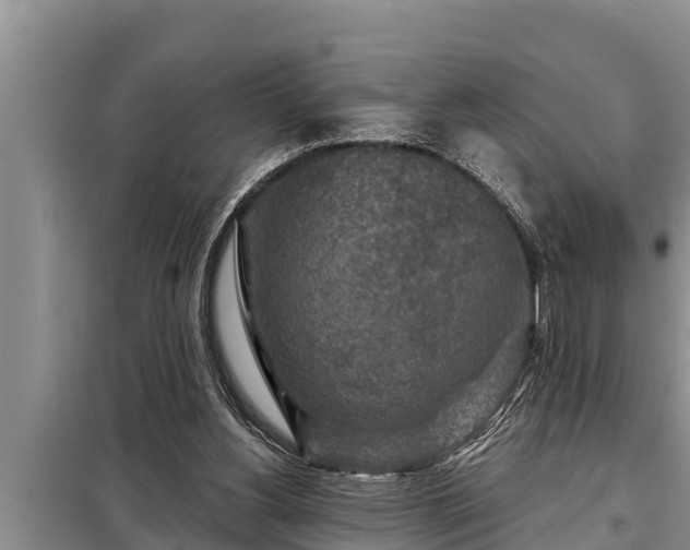 X0000098170156200805011021