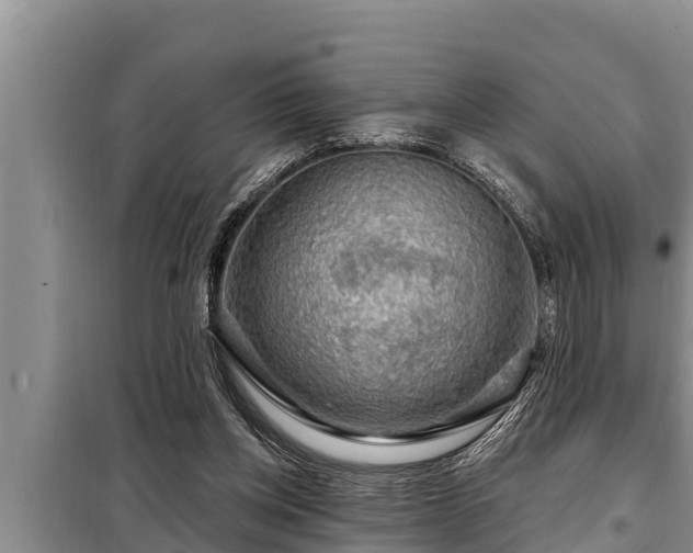 X0000098170158200805011021