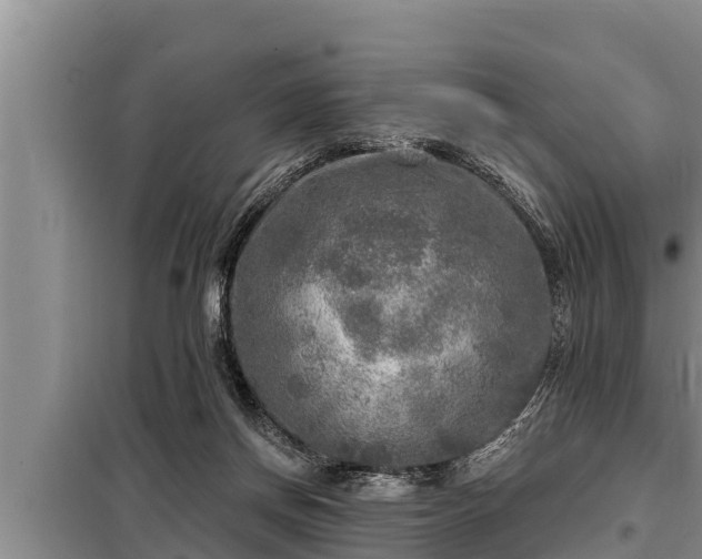 X0000098170166200805011021