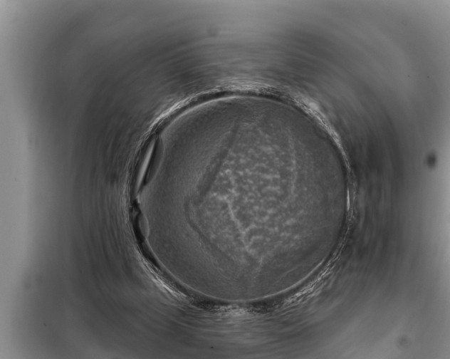 X0000098170249200805011020