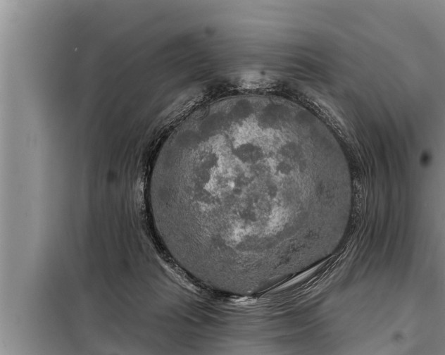 X0000098170269200805011020