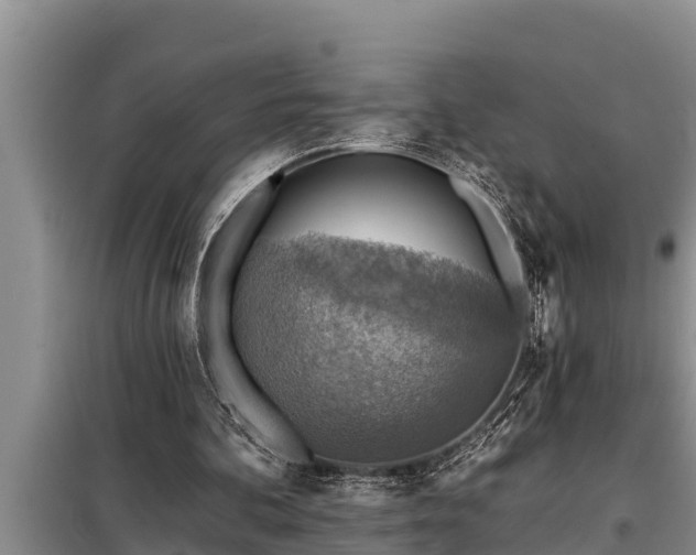 X0000098170292200805011020