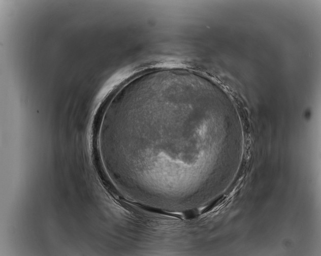 X0000098170296200805011020