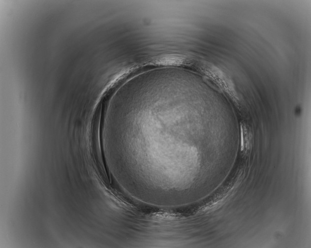 X0000098170300200805011020