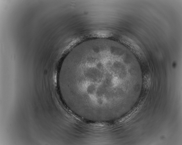 X0000098170358200805011019