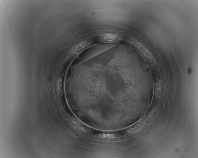 X0000098170361200805011019