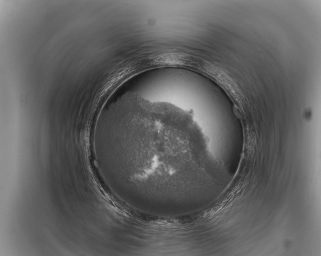 X0000098170386200805011018