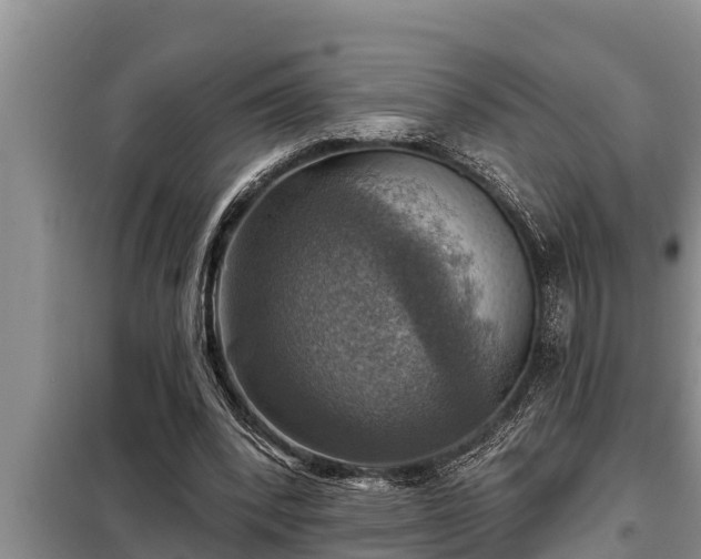 X0000098170392200805011018