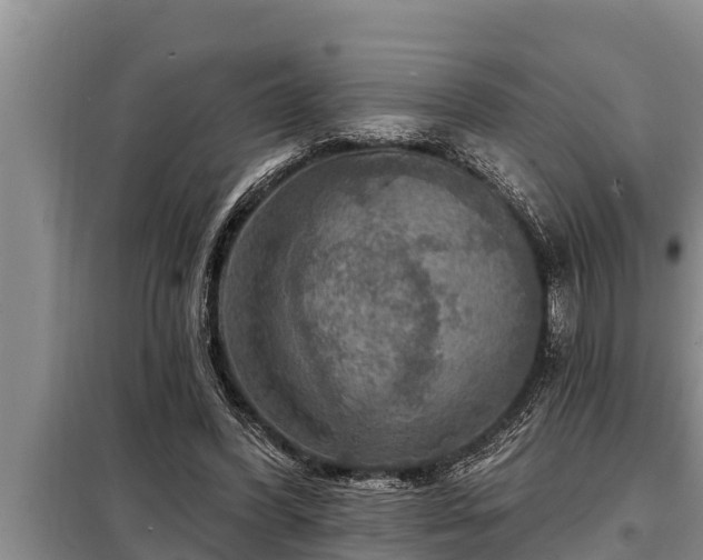 X0000098170396200805011018