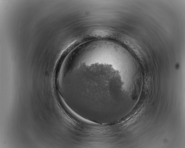 X0000098170399200805011018