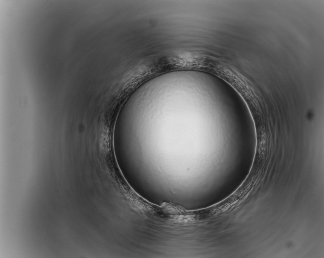 X0000098170469200805011018