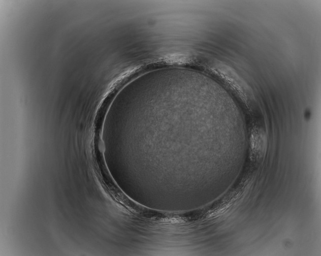 X0000098170492200805011017