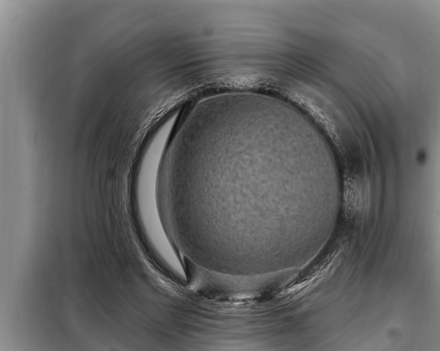 X0000098170493200805011017