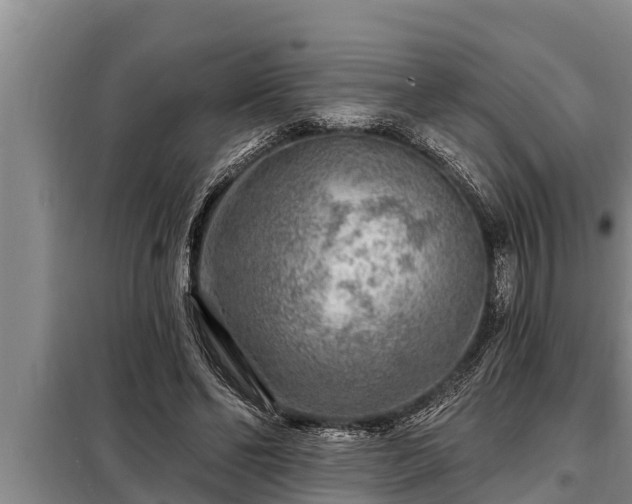 X0000098170494200805011017