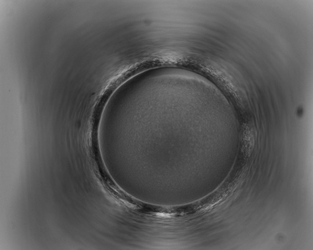 X0000098170496200805011017