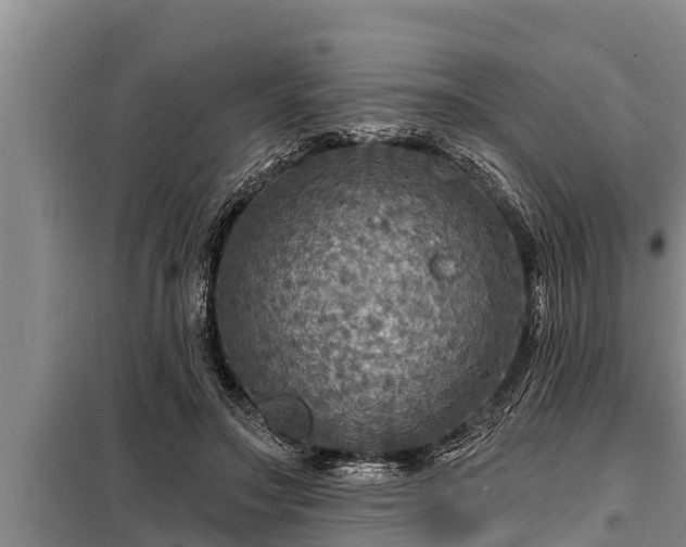 X0000098170499200805011017