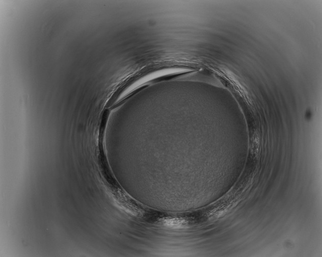 X0000098170500200805011017