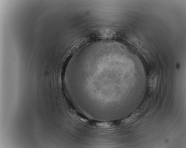 X0000098170516200805011017