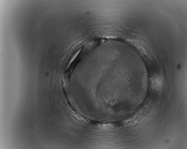 X0000098170517200805011017