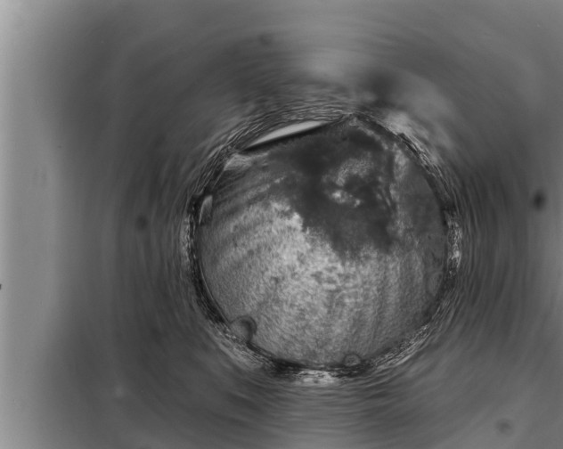 X0000098170519200805011017