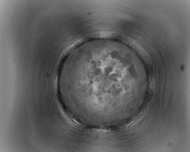 X0000098170542200805011016