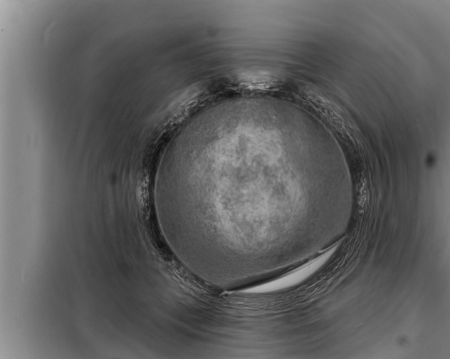 X0000098170559200805011016