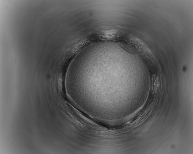 X0000098170562200805011016