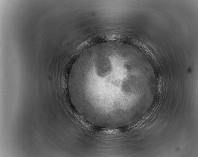 X0000098170569200805011016