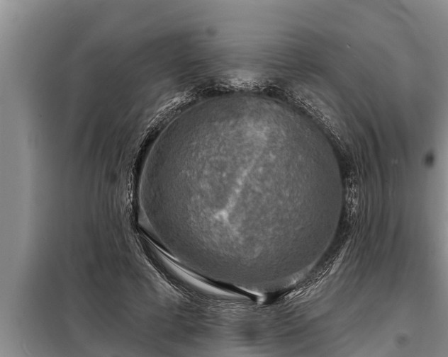 X0000098170593200805011015