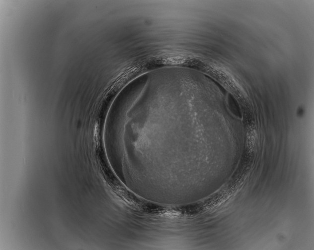 X0000098170598200805011015