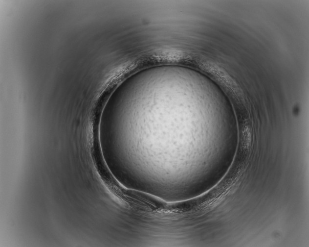 X0000098170638200805011015