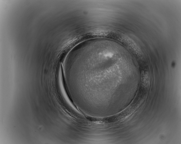 X0000098170692200805011014