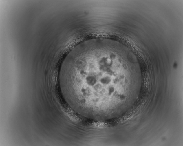 X0000098170695200805011014