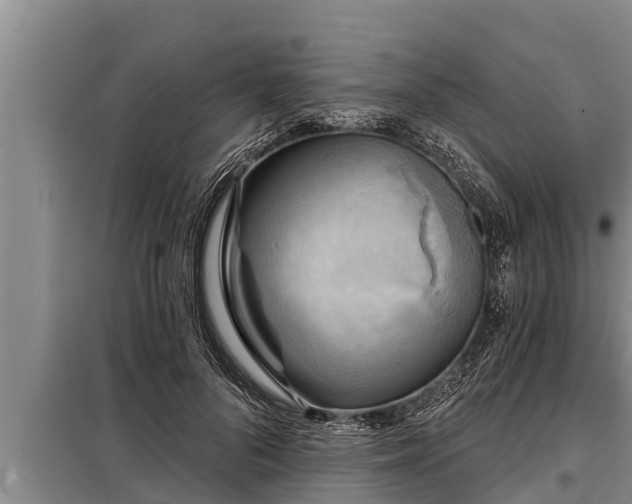 X0000098170696200805011014