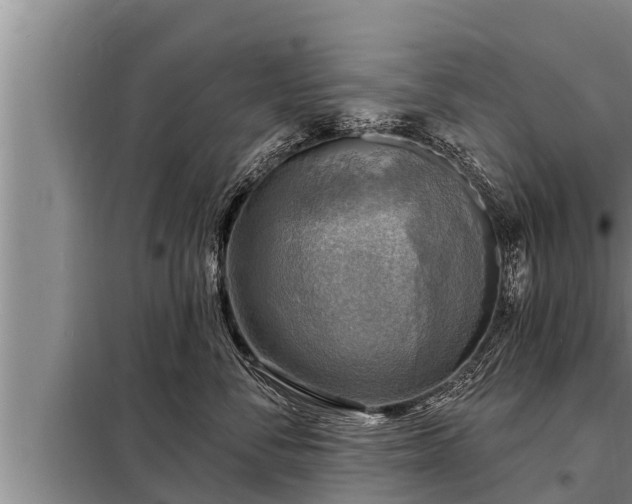 X0000098170716200805011014