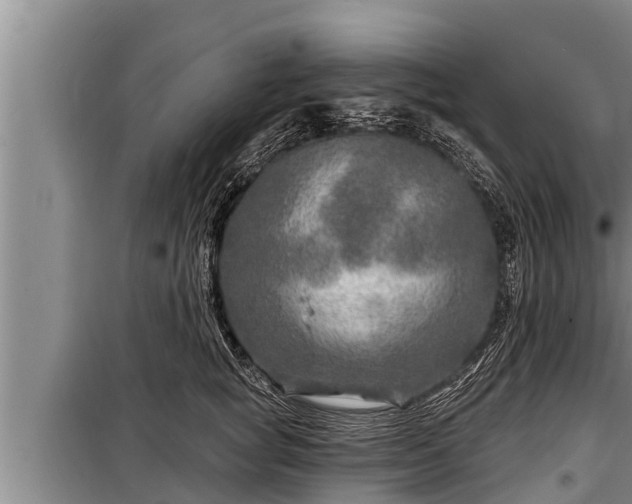 X0000098170757200805011014