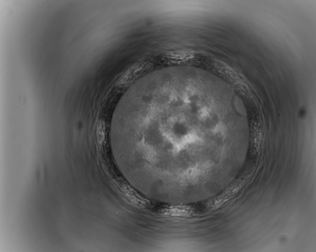 X0000098170758200805011014