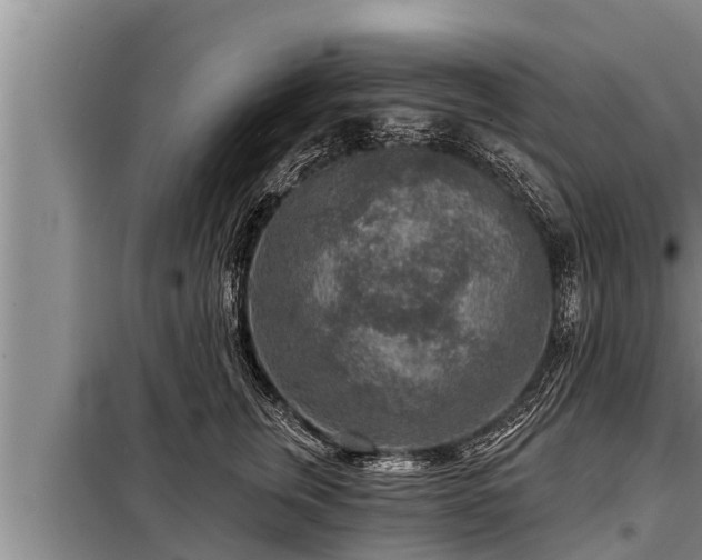 X0000098170759200805011014