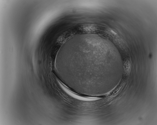 X0000098170762200805011014