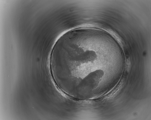 X0000098170862200805011012